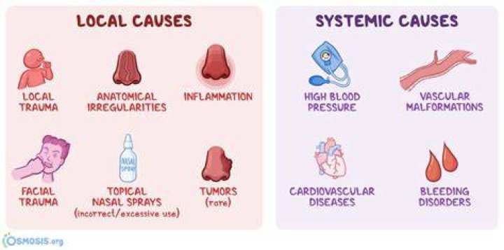 Can epistaxis causes death?