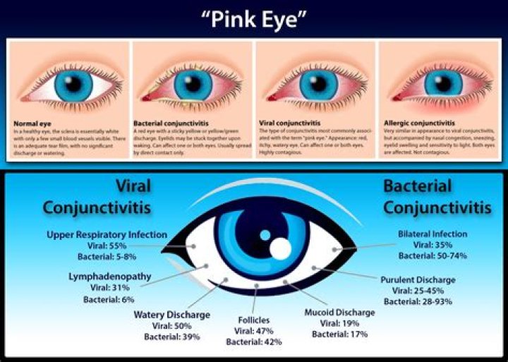 Where do pink eye come from?