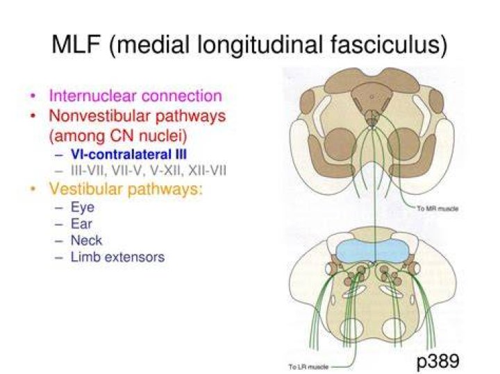 Where is mlf located?
